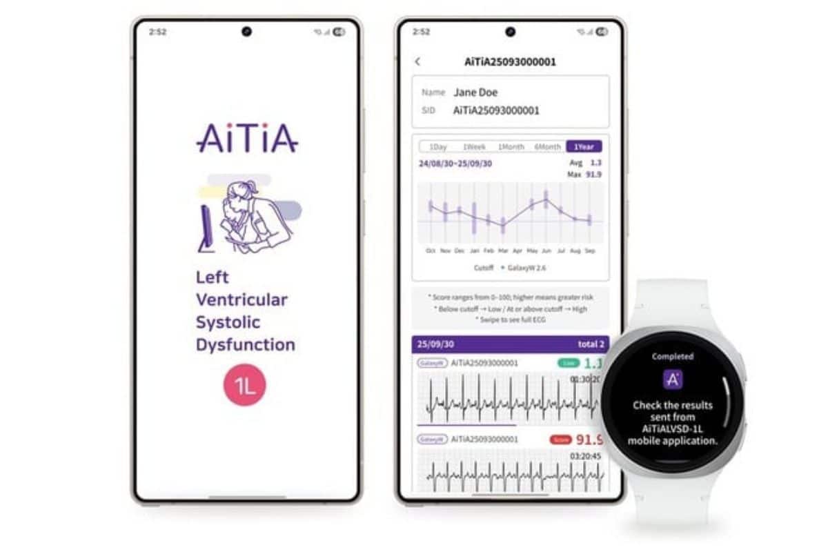 Samsung Galaxy Watch 9 rileverà l'insufficienza cardiaca